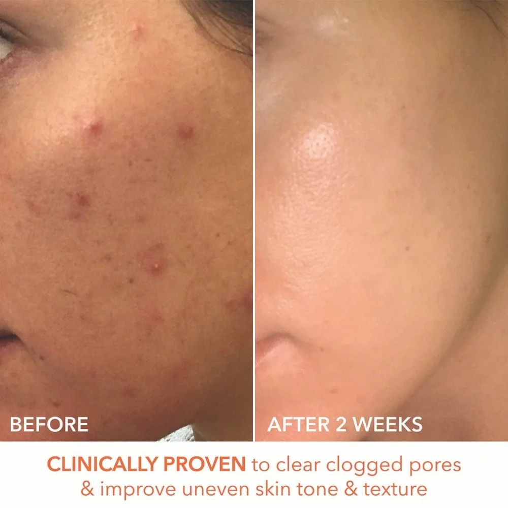 3 for $30-Dr Dennis Gross Alpha Beta Extra Strength Daily Peel Pads - Picture 6 of 16